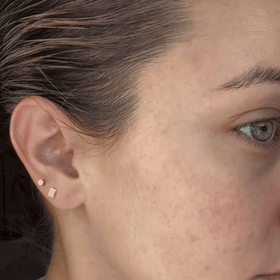 VibraLift Pro - Modernes Face Sculpting